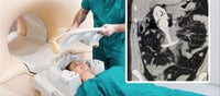 Woman Left Screaming In Pain After Séx Toy 'Pulled Through Body' During MRI Scan